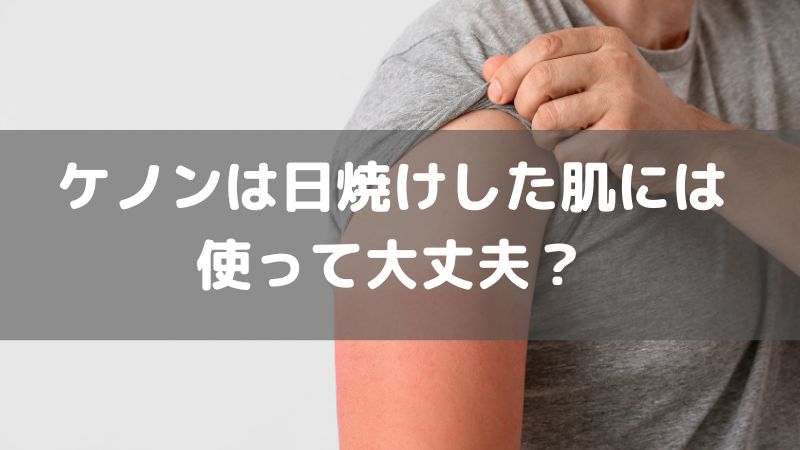 日焼けした肌でも家庭用脱毛器ケノンを使っても大丈夫？ ケノンを使用後に日焼けしたらどうなる？